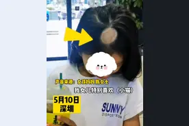 7岁女孩养猫感染头癣变秃头 妈妈说：担心她上学有压力图片