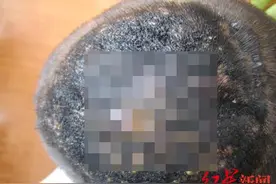9岁女孩养猫后头皮冒脓液，治愈后永久性脱发！医生紧急提醒图片