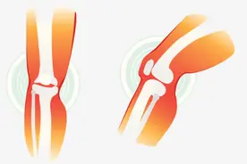 【科普】骨关节炎中医防治要略（第五期）《骨关节炎的治疗策略与方法》图片