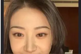 动了脸？景甜直播出镜脸上现超深沟壑 曾大方承认做双眼皮图片