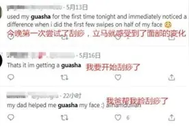 刮痧美容在海外火起来 老外被这“神秘的东方力量”折服图片