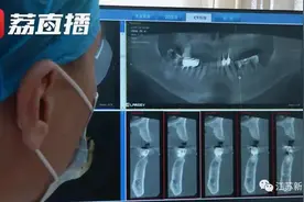 吃饭磕掉一颗牙，女子怒告饭店：糖醋排骨里有骨头！法院这么判…图片