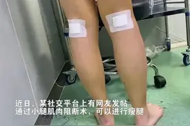 要变美先断腿？奇葩医美何时休图片