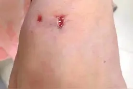 一只黑色疯狗疯狂袭击路人！江苏南通21人遇袭图片