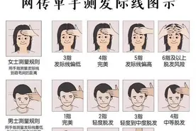 植发有风险，“脱”的很“秃”然，这届年轻人要钱还是要头发？图片