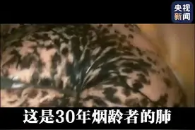 陕西公布14家规范化戒烟门诊医院，其中商洛有两家图片
