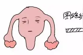 如何舒服渡过围绝经期 激素药物好帮手图片