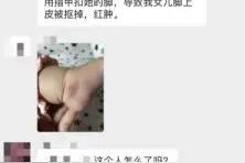 扣掉婴儿脚皮的女士和孩子住同一小区，相隔仅一栋楼图片