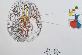 男人也分泌乳汁？烟台山医院一查：竟是脑子里长了瘤图片