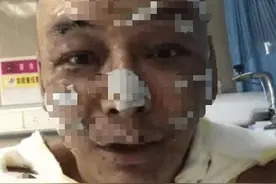 说唱歌手徐真真因点蜡烛引起火灾 全身深度烧伤图片
