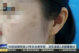 90后姑娘熬夜10年长出老年斑：没在凌晨2点前睡着过视频封面