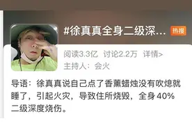 男歌手住所烧毁，全身40%深度烧伤！这个习惯很多人都有图片