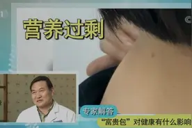 营养过剩，缺乏锻炼？小心脖子后面长“富贵包”图片