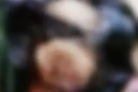 湖南小姐弟头皮长脓包块、大量脱发！竟与家中的“小可爱”有关图片