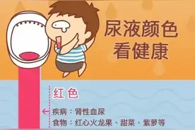 注意！小便后记得看一眼，尿液出现这 6 种颜色要当心…图片