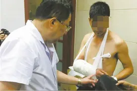 患者手腕双侧骨折，他几秒钟就徒手搞定图片
