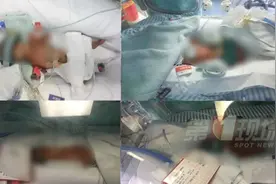 四胞胎刚出生就进ICU，消息传开行动出奇一致图片