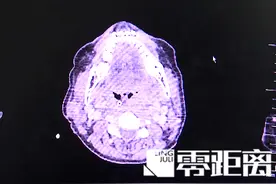 感冒喉咙痛可以吃冰棒缓解？医生给出适用范围图片