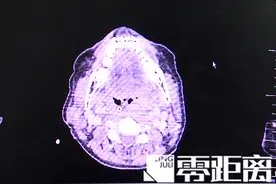 感冒喉咙痛可以吃冰棒缓解？医生给出适用范围图片