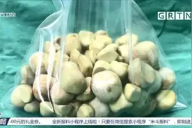七旬老伯膀胱内取出103颗结石，最大直径近2厘米图片
