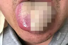 大爷在脸上画条龙，结果……面瘫了图片