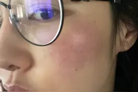 37岁白百何晒伤变“高原红”皮肤细腻度不减 自侃：化妆师疯了图片