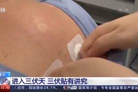 “三伏贴”不是万能贴不要胡乱贴！能贴吗？怎么贴？一文解读→图片