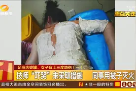 还敢随便拔火罐？女子到足浴店拔火罐，背上三度烧伤图片