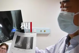 右踝反复肿痛难以行走，美国女子在汉成功手术图片