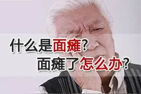 中医话面瘫丨吹了一晚空调，面瘫了图片