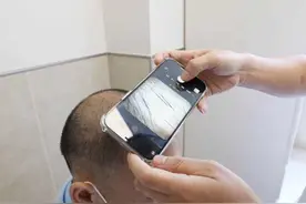 工作没几年，浓密秀发变稀疏，小伙苦恼：我爸头发都比我多图片