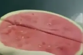 怎么让西瓜安全过夜? 医生提醒注意这两点