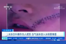 男孩脸部缝38针，只因这个操作图片