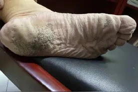 心疼！这是救援一线消防员雨靴里的脚图片