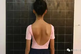 孩子会被书包压成脊柱侧弯吗？儿童医院专家一文帮你说清楚图片