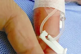 一张新生儿的手紧握产科医生手指的照片暖哭许多人图片