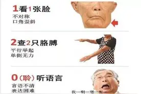 脑梗死的前驱症状有哪些图片