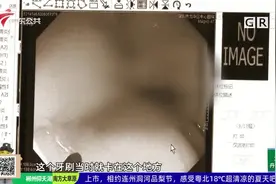 深圳：男子误吞牙刷 医生用胃镜帮患者“取剑”视频封面