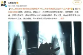 大二男生掰手腕时粉碎性骨折！你的骨头没想象的那么“硬”图片