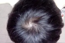 你头上有几个旋？图片