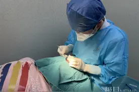 少年居家隔离时睑板腺囊肿溃烂险“破相”，医生紧急救治除眼疾图片
