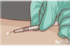 开学在即！当新冠疫苗接种遇上结核菌素试验，该怎么办？图片