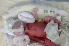 全国首例确诊三胞胎孕妇在瑞丽生产图片