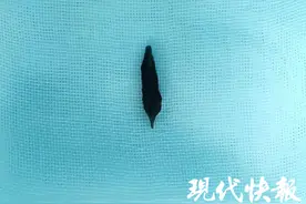 2岁女童肛门反复流脓，“真凶”竟然是一粒枣核图片