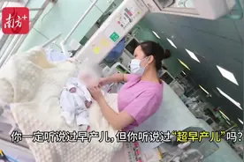 孕22周，出生仅498克，国内罕见超早产儿创生命奇迹图片