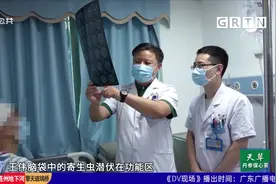 吃蛇肉吞蛇胆喝蛇酒 男子颅内长“懒虫”视频封面