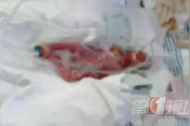 “大力”出奇迹！“超早产儿”出院啦图片