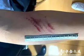 暴力阻碍执法致民警受伤 枞阳警方查处一起袭警案图片