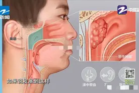 谁说癌症就是绝症？这种癌治愈率高达90%，羽坛名匠李宗伟33次治疗最终战胜疾病图片