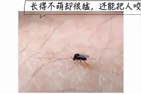 惊呆了！女子公园野餐后，小腿上布满密密麻麻的……最近户外多发图片